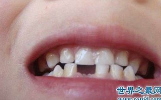 做梦掉牙齿(做梦掉牙齿什么意思周公解梦)