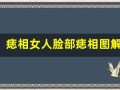 痣相女人脸部痣相图解(痣相女人脸部痣相图解怎么看左右)