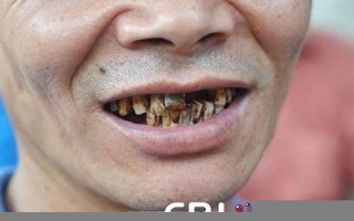周公解梦梦见掉牙齿(周公解梦梦见掉牙齿一吐一大把)