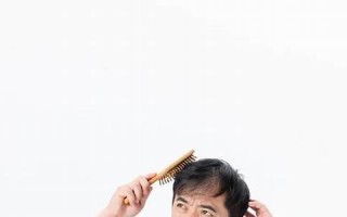 梦见自己秃顶(梦见自己秃顶头发掉了一大块)