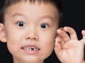 梦见自己牙掉了(梦见自己牙掉了好多颗是什么意思)