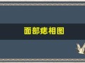 面部痣相图(面部痣相图解女人左右怎么看)