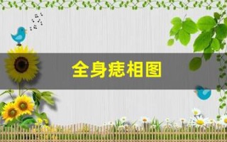 全身痣相图(全身痣相图解大全)