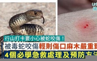 被蛇咬(被蛇咬了做梦是什么意思)